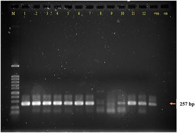 High Occurrence Among Calves and Close Phylogenetic Relationships With Human Viruses Warrants Close Surveillance of Rotaviruses in Kuwaiti Dairy Farms